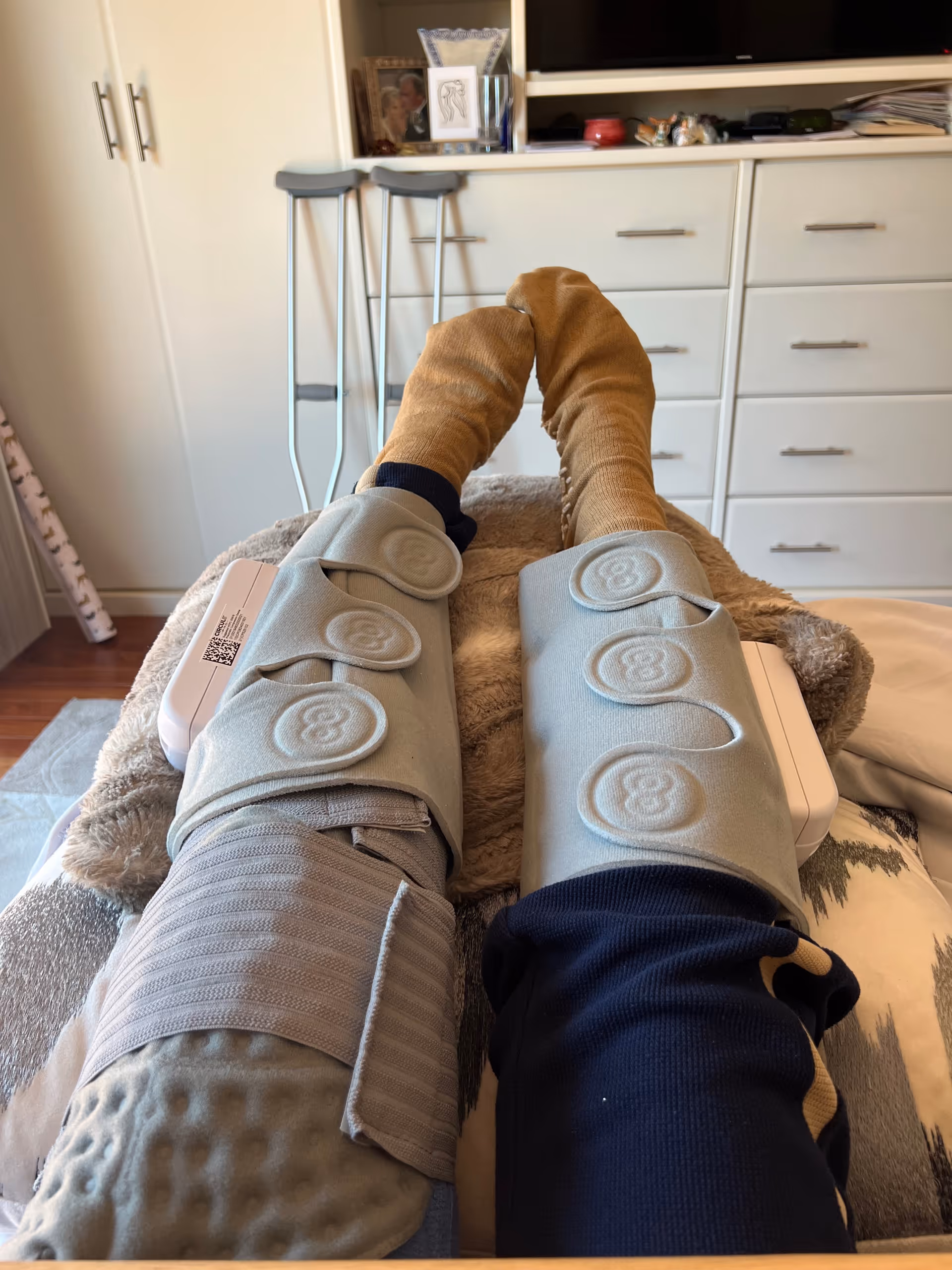 Legs with light blue orthopedic braces resting on a bed in a bedroom.