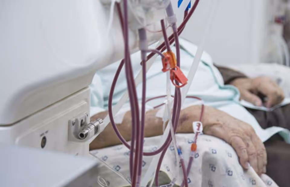Close view of a patient in a hospital bed with IV lines and tubing.