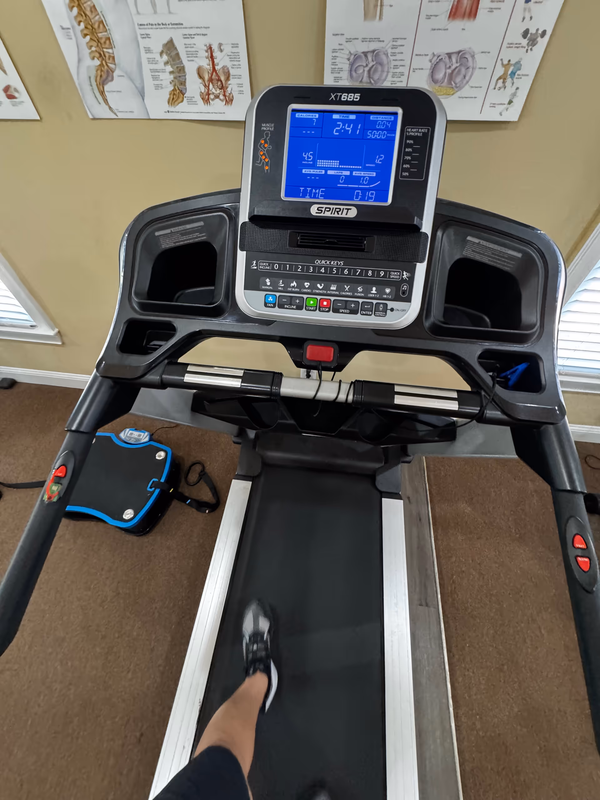 A treadmill in a rehab gym with a person walking; anatomy posters on the wall behind.