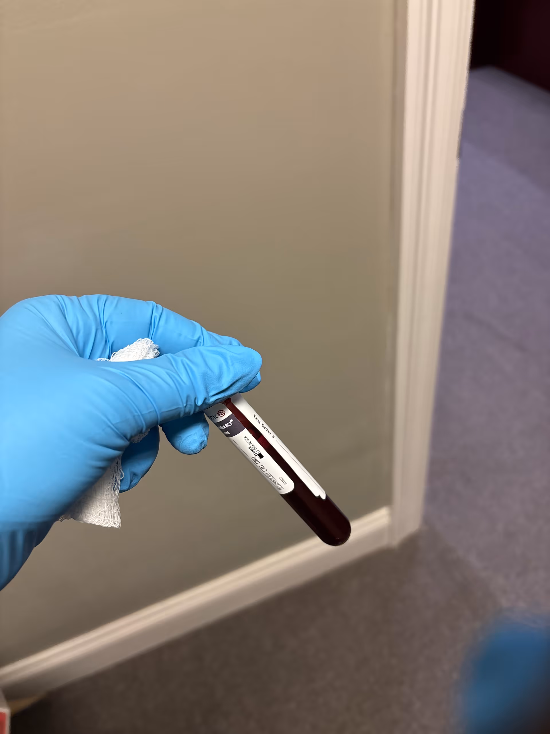Gloved hand holding a blood sample tube indoors near a wall.