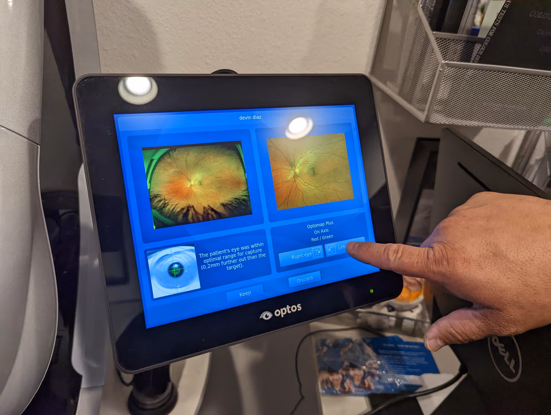Close-up of a tablet-like optical retina imaging screen showing two eye photographs beside a pointing finger.