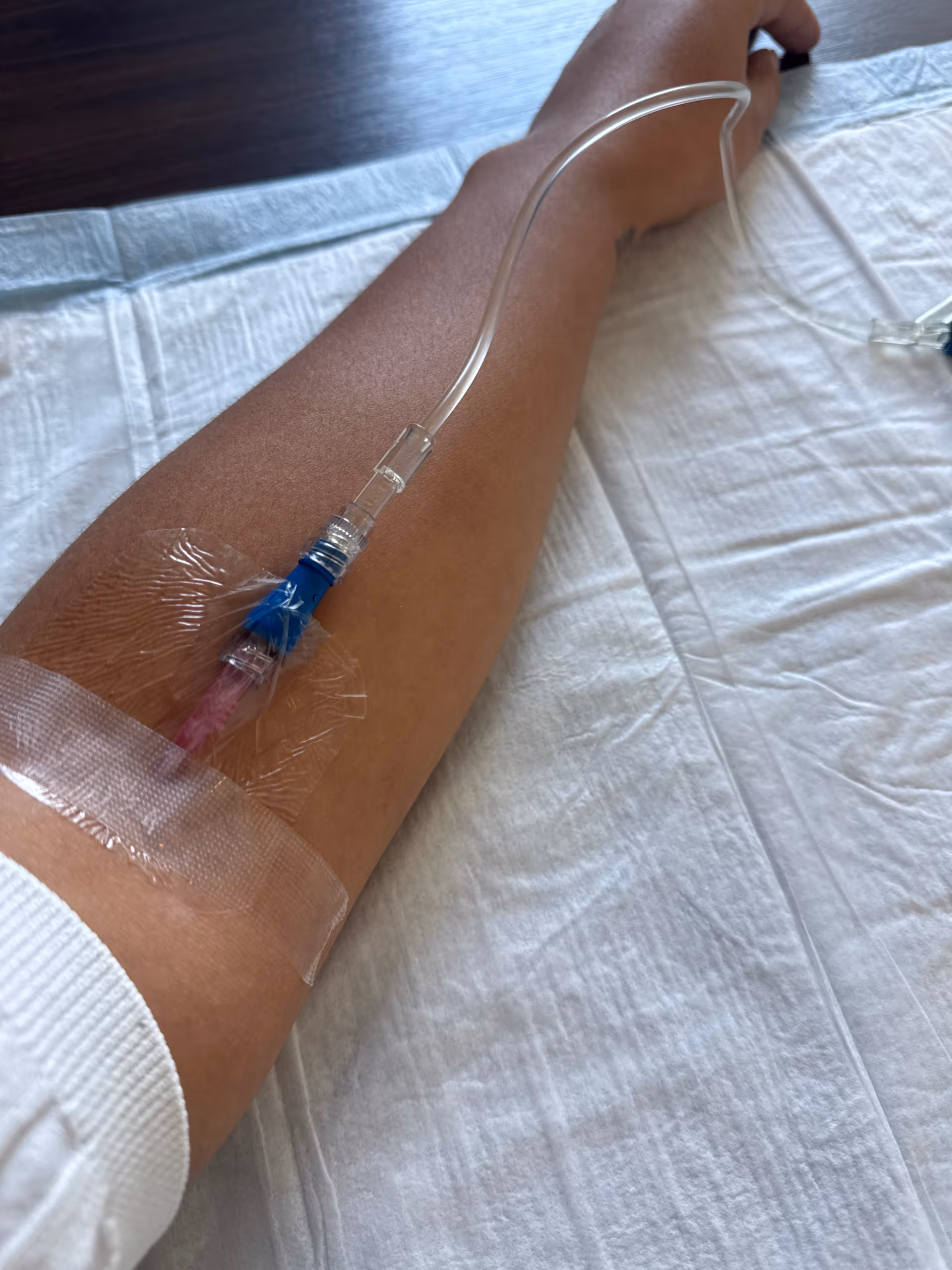 Close-up of a patient's arm with an IV line secured by tape.