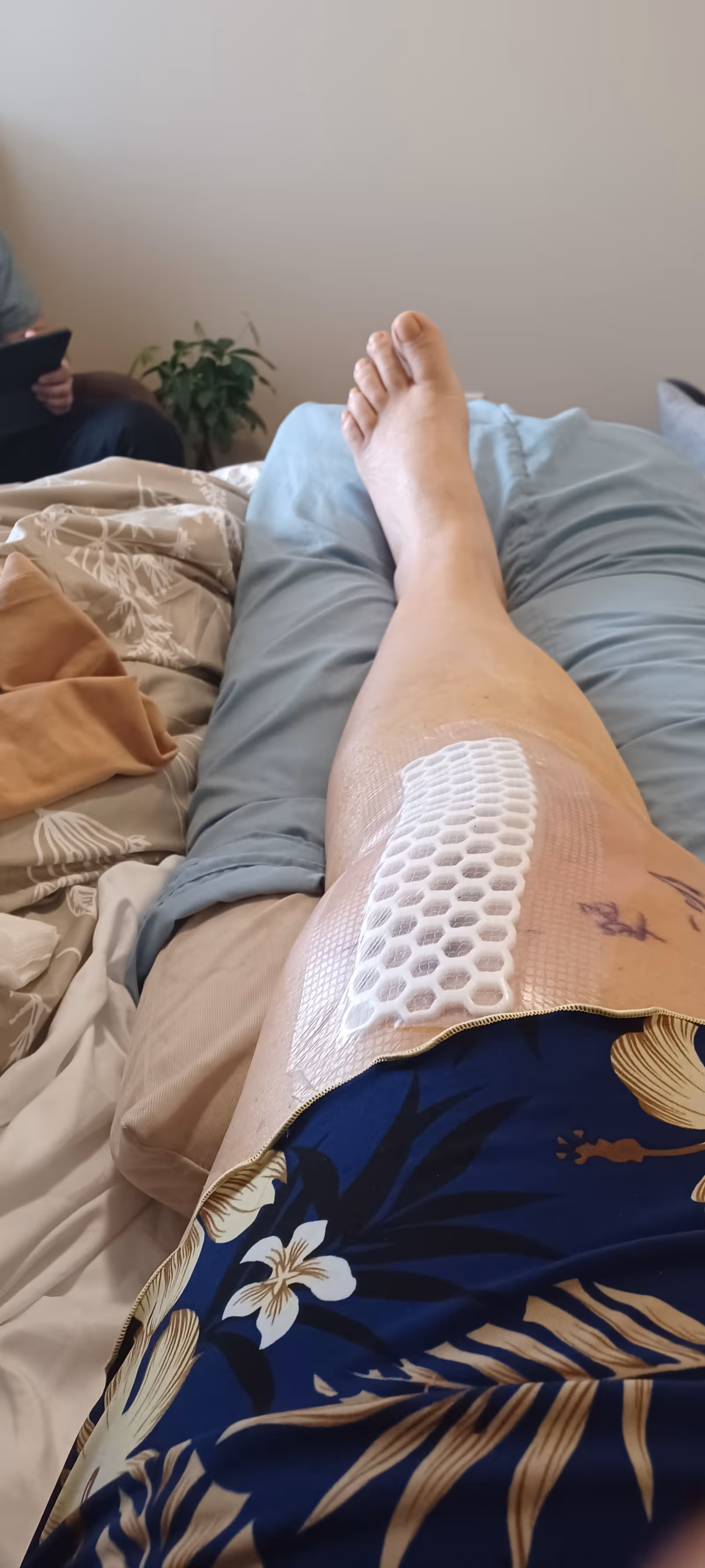 Leg wrapped in honeycomb compression wrap resting on a bed