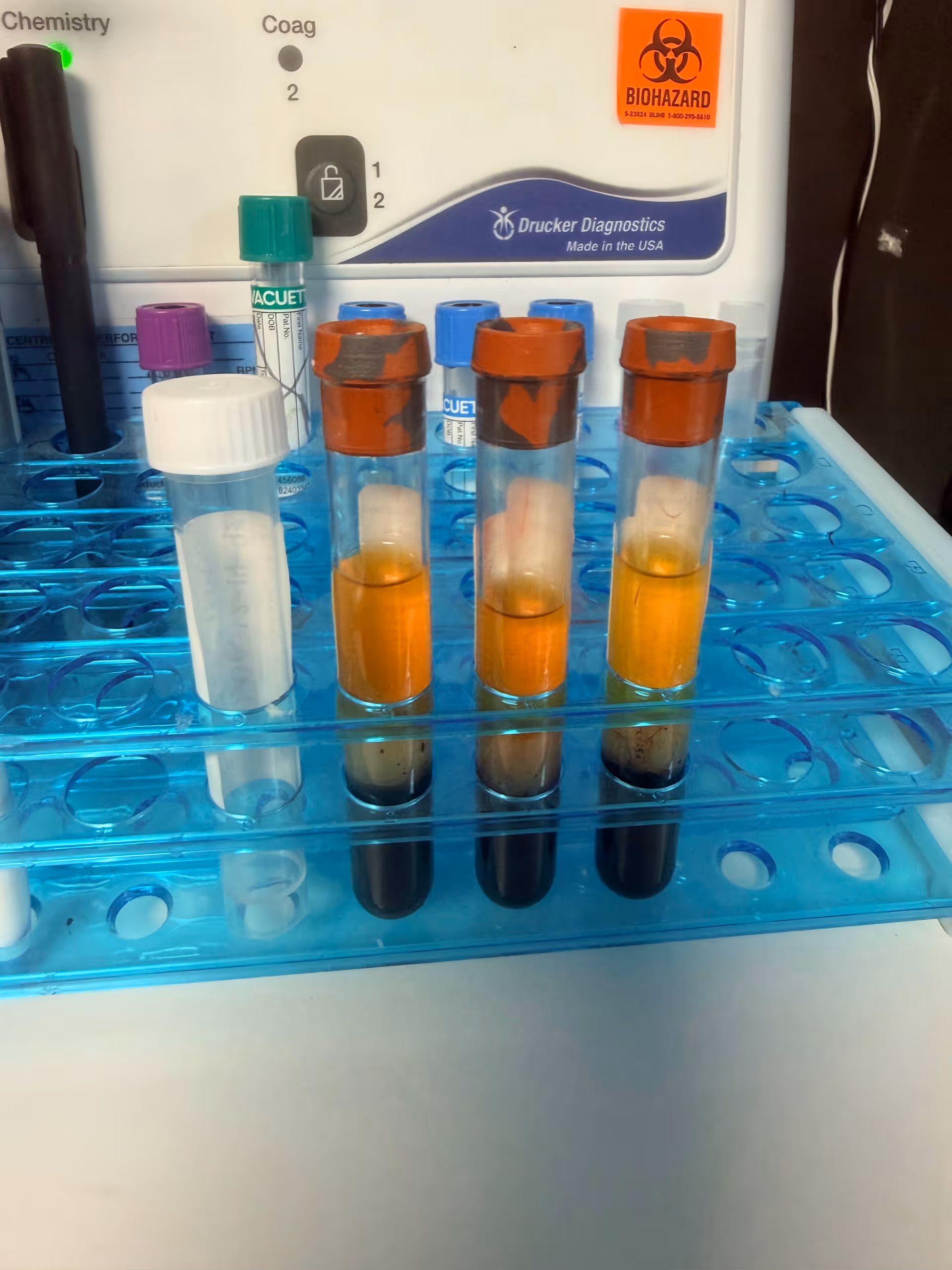 Lab bench with test tubes in a blue rack and a biohazard sticker.