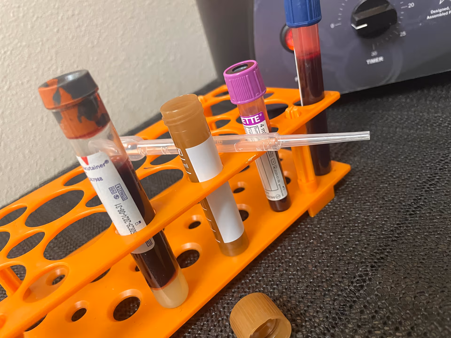 Blood collection tubes in an orange rack on a dark countertop, with centrifuge in the background.