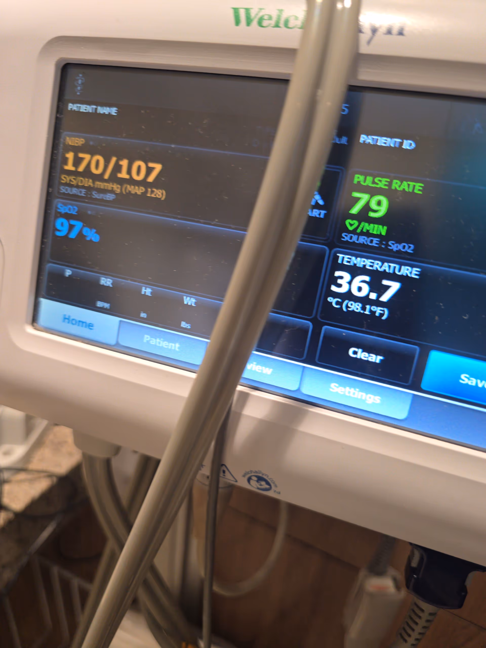 Close-up of a medical monitor displaying vitals in an ER hospital room.