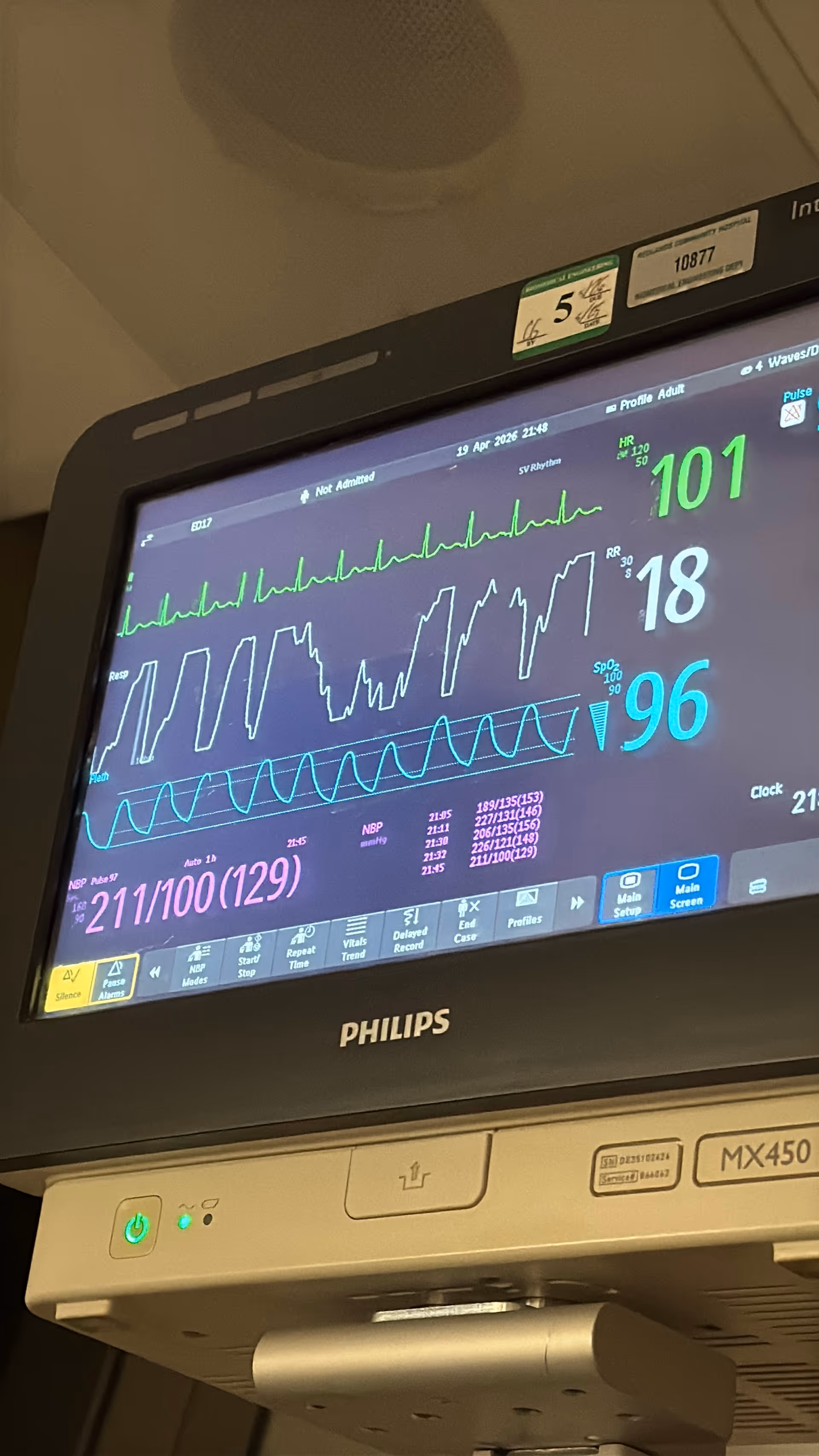 Philips medical monitor showing vital signs and graphs in the emergency room.